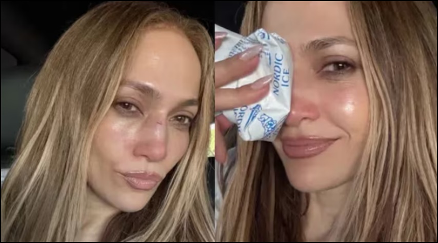 రిహార్సల్స్ సమయంలో జెన్నిఫర్ లోపెజ్‌కు గాయాలు..